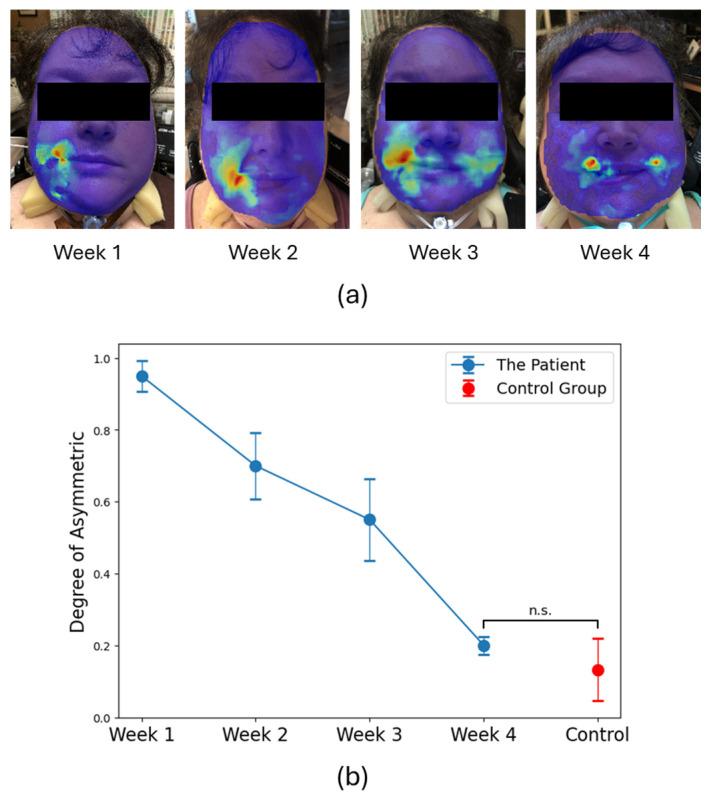 https://cdn.ncbi.nlm.nih.gov/pmc/blobs/0124/12249283/c11024b3b8ab/diagnostics-15-01574-g003.jpg