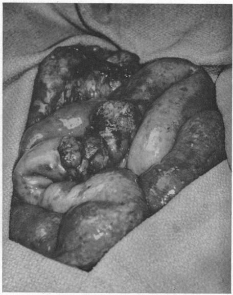 https://cdn.ncbi.nlm.nih.gov/pmc/blobs/0124/1516142/f94ac40dc953/califmed00072-0055-a.jpg