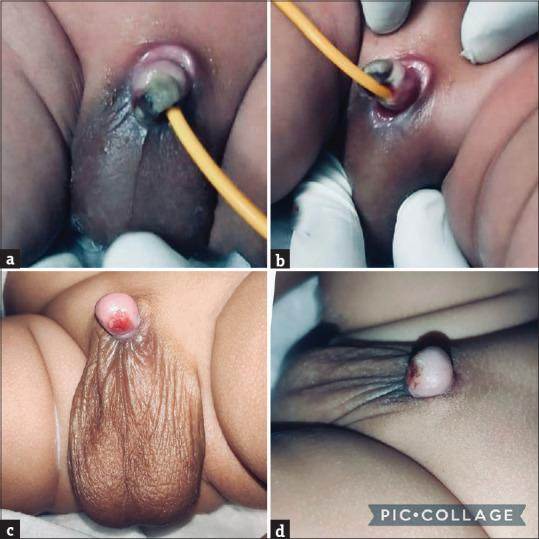 https://cdn.ncbi.nlm.nih.gov/pmc/blobs/0125/12316417/ac6e49dcd896/JIAPS-30-529-g001.jpg