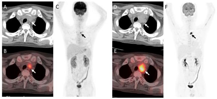 https://cdn.ncbi.nlm.nih.gov/pmc/blobs/0128/10296960/21dfefe1e832/diagnostics-13-02027-g003.jpg