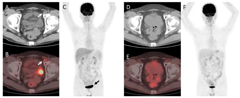 https://cdn.ncbi.nlm.nih.gov/pmc/blobs/0128/10296960/9911baf4b521/diagnostics-13-02027-g002.jpg
