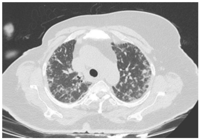 https://cdn.ncbi.nlm.nih.gov/pmc/blobs/012e/11944207/46ec91845f00/medicina-61-00549-g001.jpg