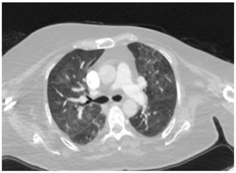 https://cdn.ncbi.nlm.nih.gov/pmc/blobs/012e/11944207/5eea78ea8a4c/medicina-61-00549-g002.jpg