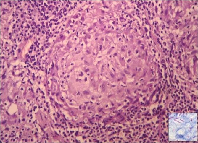 https://cdn.ncbi.nlm.nih.gov/pmc/blobs/0130/2965907/bdaf024b8bdc/IJD-55-233-g005.jpg