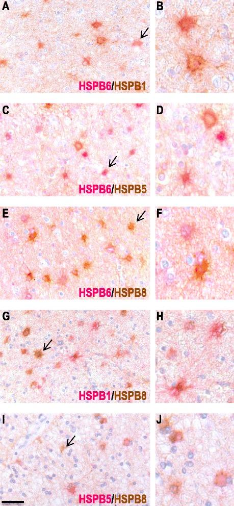 https://cdn.ncbi.nlm.nih.gov/pmc/blobs/0133/4688967/aff10ce483ce/40478_2015_267_Fig8_HTML.jpg