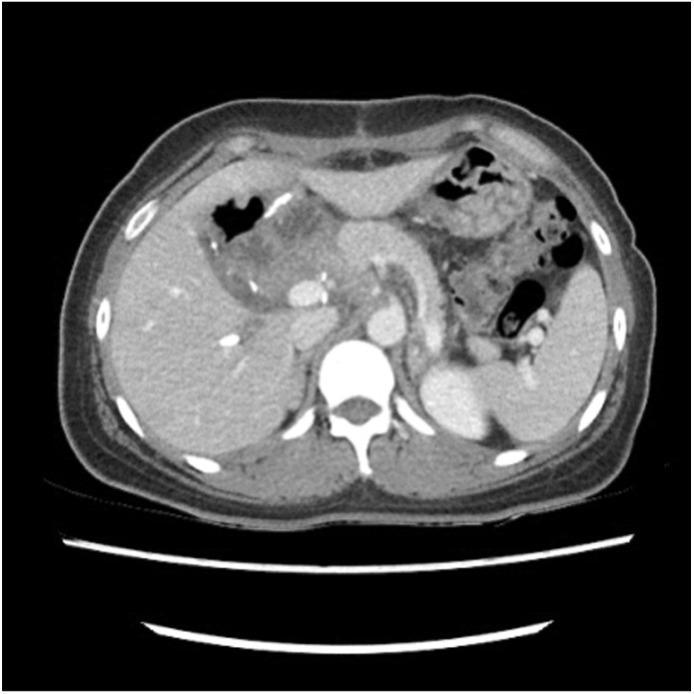 https://cdn.ncbi.nlm.nih.gov/pmc/blobs/0135/8180395/fcda2a1a7964/ahbps-25-2-287-f6.jpg