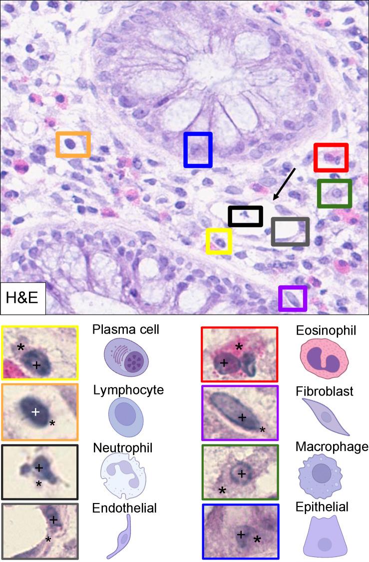 https://cdn.ncbi.nlm.nih.gov/pmc/blobs/0139/11756763/d5284aec4f9e/pcbi.1012708.g001.jpg