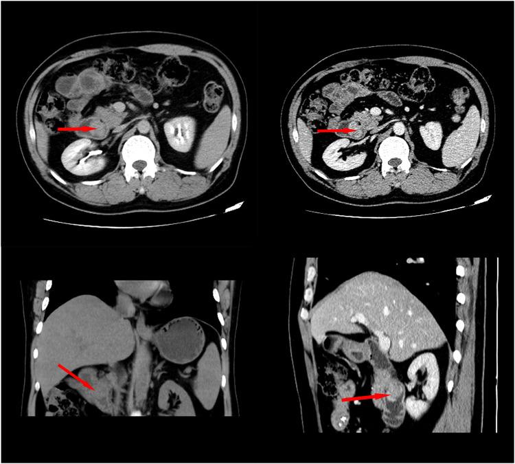 https://cdn.ncbi.nlm.nih.gov/pmc/blobs/013a/9299241/2abb599e7907/fsurg-09-926003-g001.jpg