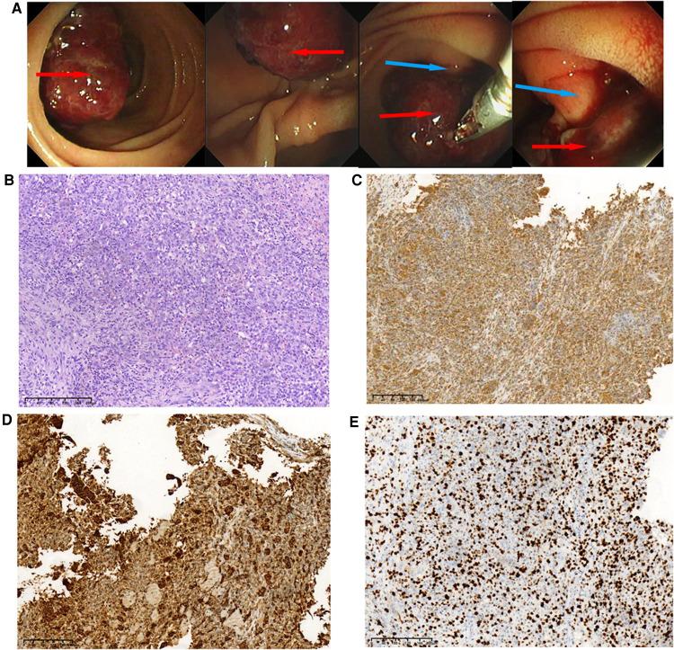 https://cdn.ncbi.nlm.nih.gov/pmc/blobs/013a/9299241/655e84692c97/fsurg-09-926003-g002.jpg