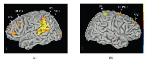 https://cdn.ncbi.nlm.nih.gov/pmc/blobs/013c/2906181/fe3937b85188/IJBI2010-840416.004.jpg