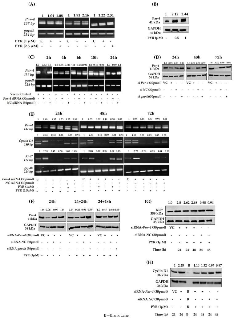https://cdn.ncbi.nlm.nih.gov/pmc/blobs/013f/9264948/baa63fc4f9cb/cancers-14-03198-g007.jpg