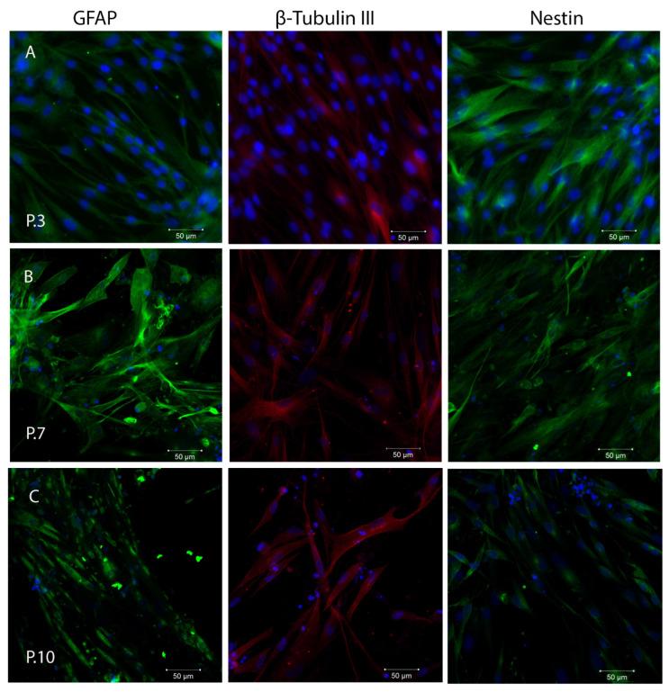 https://cdn.ncbi.nlm.nih.gov/pmc/blobs/0144/10743411/e7b53c152858/ijms-24-17249-g005.jpg