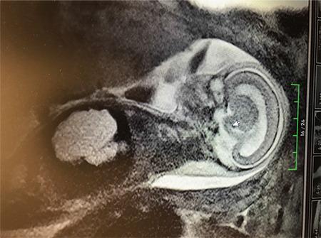https://cdn.ncbi.nlm.nih.gov/pmc/blobs/0146/7944237/454668c6d5f9/JTGGA-22-71-g1.jpg