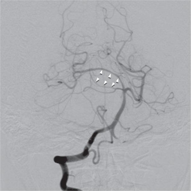 https://cdn.ncbi.nlm.nih.gov/pmc/blobs/014f/4533488/d7464ac55172/nmc-54-654-g2.jpg