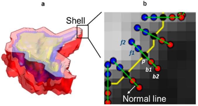 https://cdn.ncbi.nlm.nih.gov/pmc/blobs/0152/8199879/2af3daae0117/cancers-13-02781-g003.jpg