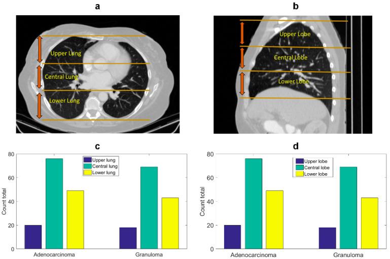 https://cdn.ncbi.nlm.nih.gov/pmc/blobs/0152/8199879/6c5c7fa820fb/cancers-13-02781-g0A1.jpg
