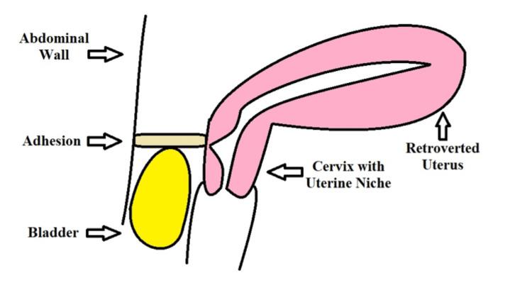 https://cdn.ncbi.nlm.nih.gov/pmc/blobs/0153/10544643/d2721bc13650/cureus-0015-00000044521-i02.jpg