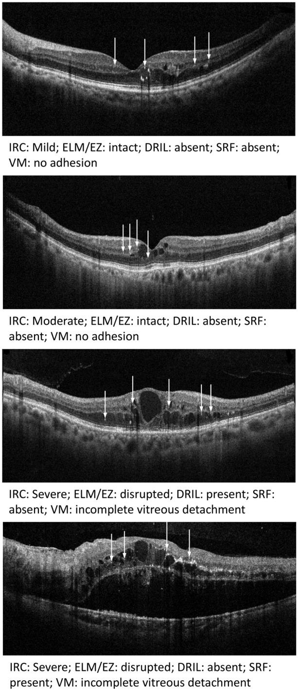 https://cdn.ncbi.nlm.nih.gov/pmc/blobs/0159/9587150/47055ff71507/40123_2022_576_Fig1_HTML.jpg