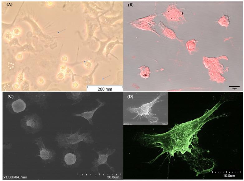 https://cdn.ncbi.nlm.nih.gov/pmc/blobs/015b/10931270/817e990d1955/cells-13-00445-g002.jpg