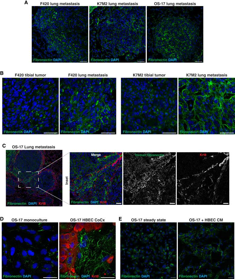 https://cdn.ncbi.nlm.nih.gov/pmc/blobs/0165/11739783/1b5251cc05f8/ccr-24-0049_f4.jpg