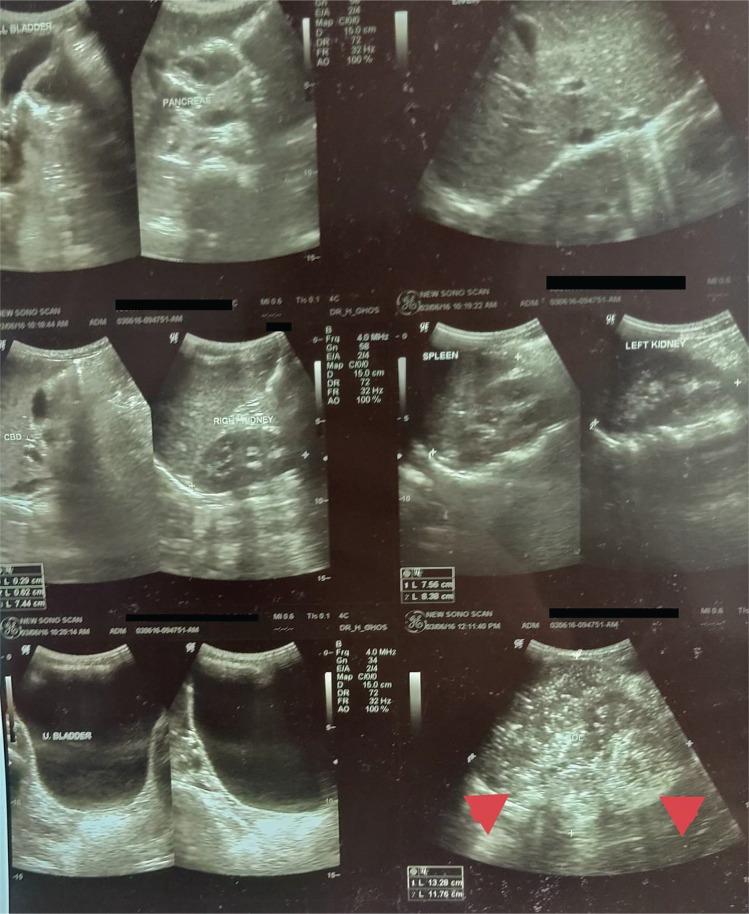https://cdn.ncbi.nlm.nih.gov/pmc/blobs/0166/10213384/c83ebeeb8613/JAFES-38-1-108-g001.jpg