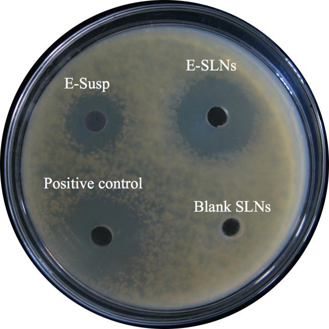 https://cdn.ncbi.nlm.nih.gov/pmc/blobs/016d/8643199/a7c65178f4c6/IJN-16-7847-g0004.jpg