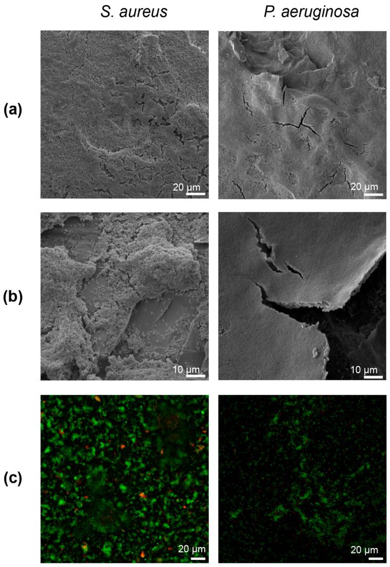 https://cdn.ncbi.nlm.nih.gov/pmc/blobs/016f/11356137/f1d8e7f592cd/microorganisms-12-01588-g003.jpg