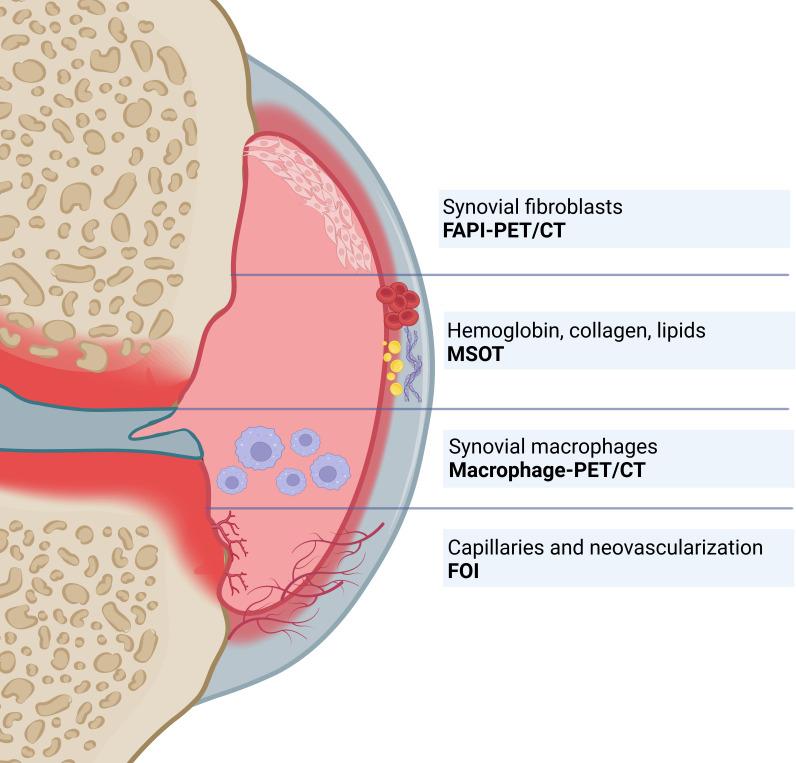 https://cdn.ncbi.nlm.nih.gov/pmc/blobs/0171/10862311/73677133437d/rmdopen-2023-003880f02.jpg