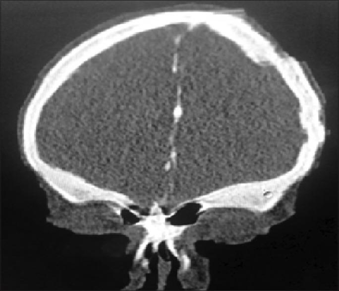 https://cdn.ncbi.nlm.nih.gov/pmc/blobs/0172/8491327/9b75d3e934e6/JOMFP-25-373a-g003.jpg