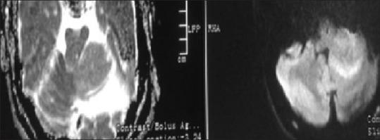 https://cdn.ncbi.nlm.nih.gov/pmc/blobs/0172/8491327/a4425f68a32c/JOMFP-25-373a-g008.jpg