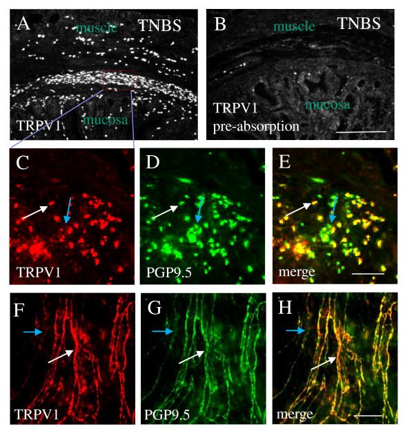 https://cdn.ncbi.nlm.nih.gov/pmc/blobs/0181/3298724/e52e75c57e37/1742-2094-9-30-2.jpg