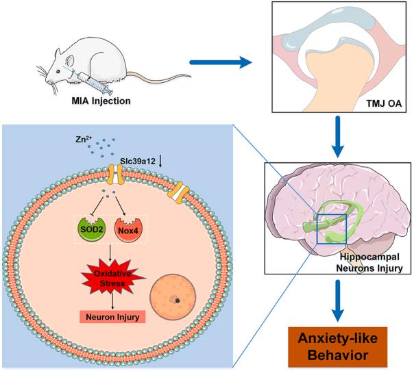 https://cdn.ncbi.nlm.nih.gov/pmc/blobs/0186/10875581/16a67dea2f9b/ga1.jpg