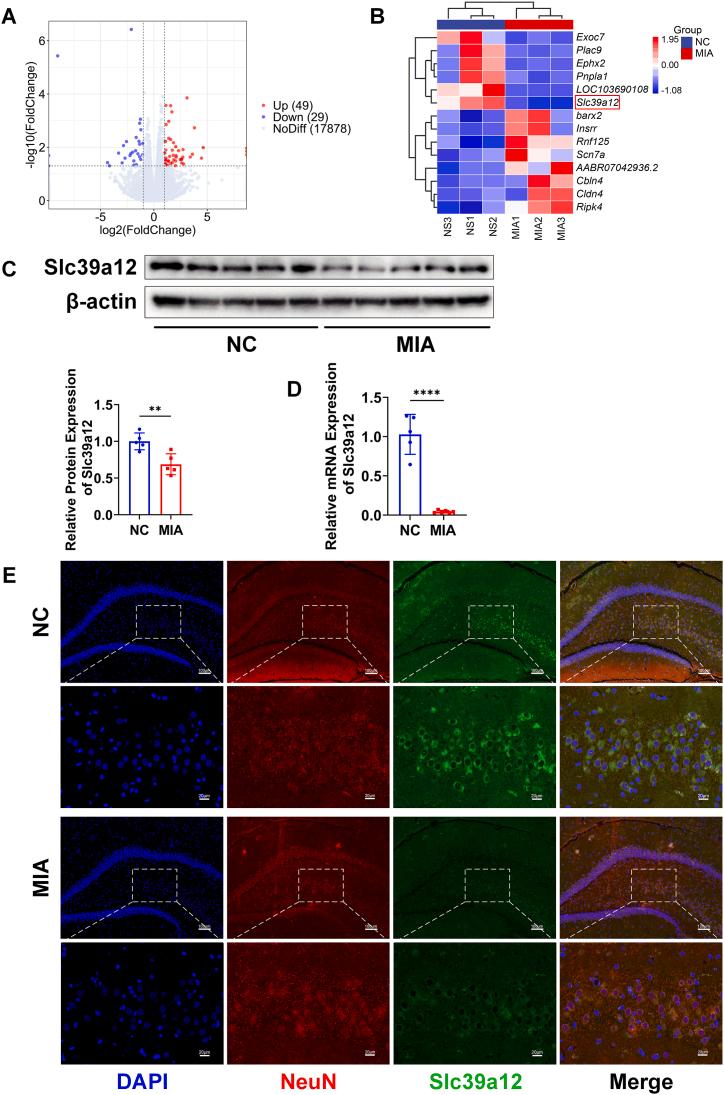 https://cdn.ncbi.nlm.nih.gov/pmc/blobs/0186/10875581/6ac6693aa67f/gr4.jpg