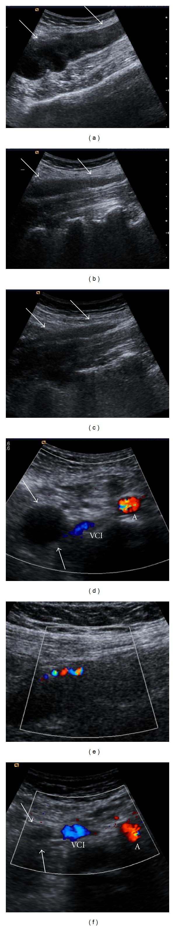 https://cdn.ncbi.nlm.nih.gov/pmc/blobs/0188/3485490/569f3ef1cd5a/CRIM.OBGYN2012-134603.001.jpg