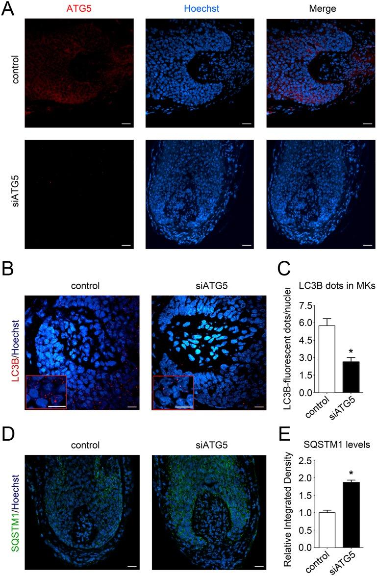 https://cdn.ncbi.nlm.nih.gov/pmc/blobs/018d/5891029/e4658299dae9/pbio.2002864.g004.jpg