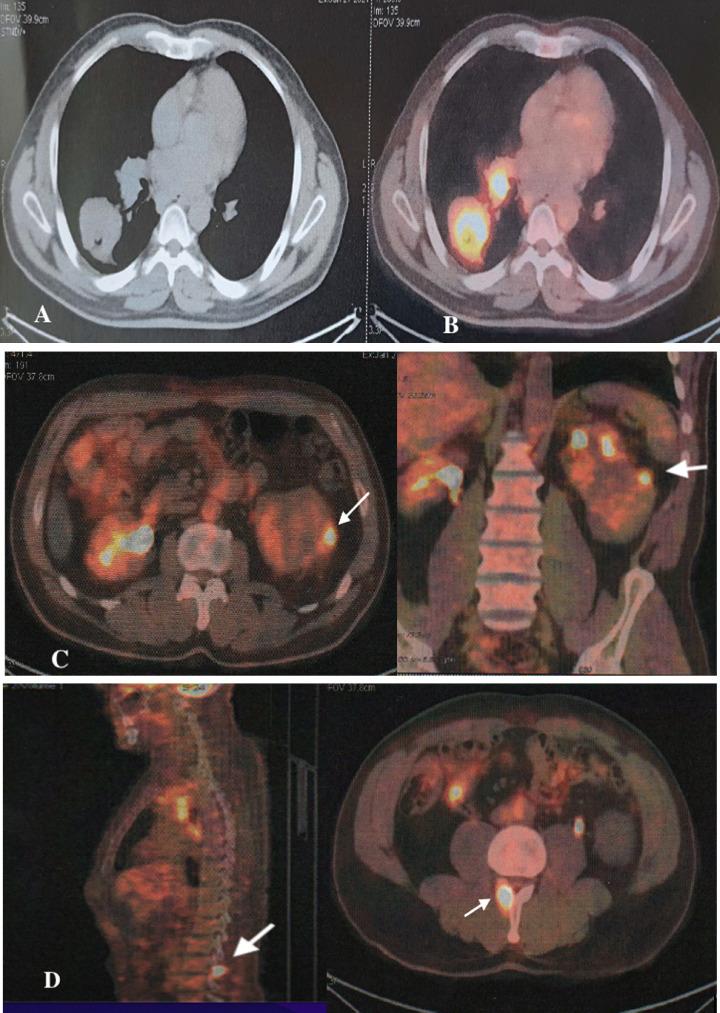 https://cdn.ncbi.nlm.nih.gov/pmc/blobs/018e/8899109/4647e078a991/gr2.jpg