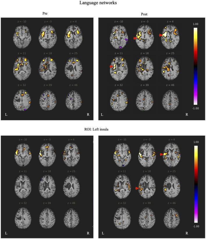 https://cdn.ncbi.nlm.nih.gov/pmc/blobs/019b/9535658/ab852e7cbffa/fnhum-16-870733-g0004.jpg