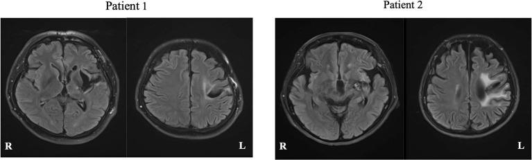 https://cdn.ncbi.nlm.nih.gov/pmc/blobs/019b/9535658/c85faefff487/fnhum-16-870733-g0003.jpg