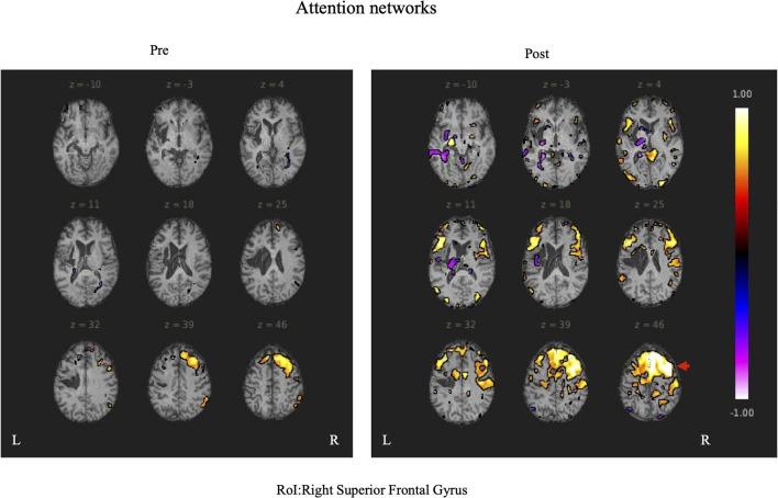 https://cdn.ncbi.nlm.nih.gov/pmc/blobs/019b/9535658/fa547d728917/fnhum-16-870733-g0005.jpg