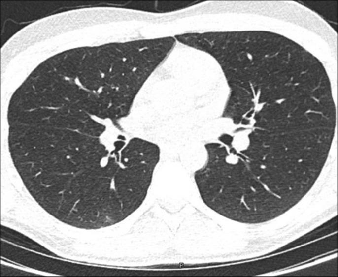 https://cdn.ncbi.nlm.nih.gov/pmc/blobs/01aa/7447367/37e1ca43c2ac/ac9-7-e00438-g003.jpg