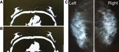 https://cdn.ncbi.nlm.nih.gov/pmc/blobs/01ab/2175019/1133de247778/266_2007_9019_Fig5_HTML.jpg