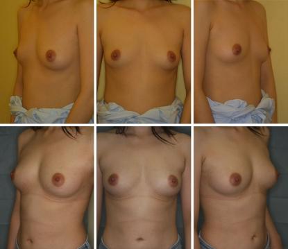 https://cdn.ncbi.nlm.nih.gov/pmc/blobs/01ab/2175019/39b6d22924ab/266_2007_9019_Fig6_HTML.jpg
