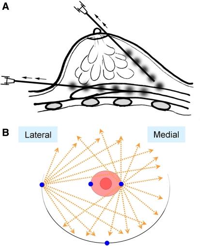 https://cdn.ncbi.nlm.nih.gov/pmc/blobs/01ab/2175019/996a2b442f89/266_2007_9019_Fig2_HTML.jpg