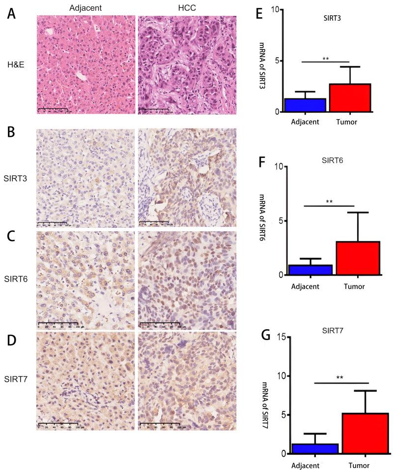 https://cdn.ncbi.nlm.nih.gov/pmc/blobs/01ac/11164202/11b1cfd7e74f/IJGM-17-2655-g0007.jpg