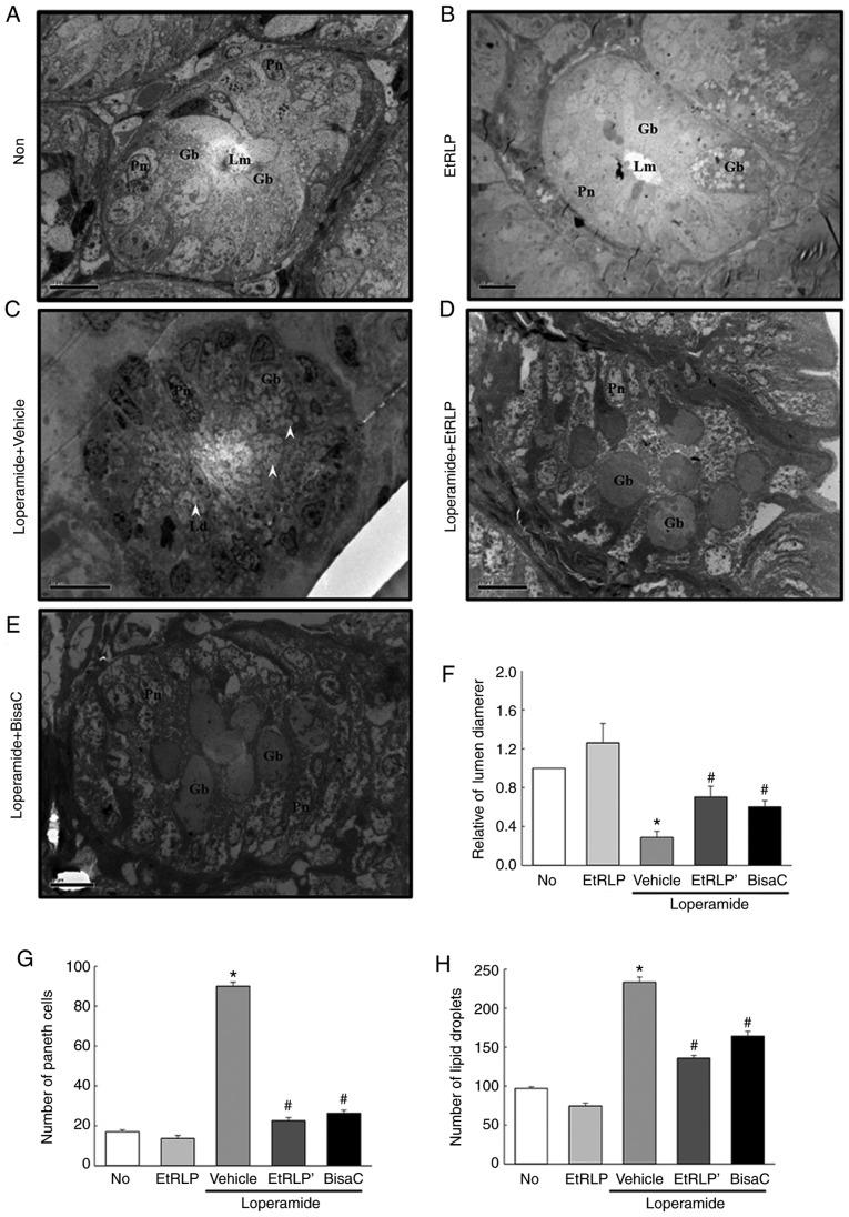 https://cdn.ncbi.nlm.nih.gov/pmc/blobs/01ae/6257849/91563c58fea9/IJMM-43-01-0185-g05.jpg