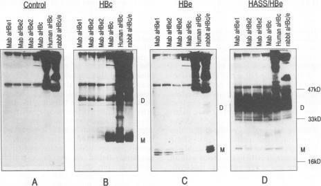 https://cdn.ncbi.nlm.nih.gov/pmc/blobs/01b8/250773/c97dc08f8862/jvirol00055-0457-a.jpg