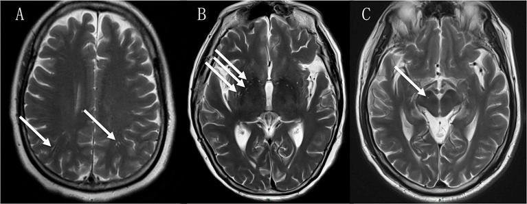 https://cdn.ncbi.nlm.nih.gov/pmc/blobs/01b9/9557144/133420759cf9/fimmu-13-966781-g001.jpg