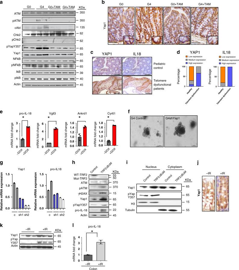 https://cdn.ncbi.nlm.nih.gov/pmc/blobs/01bd/7505960/09faae7687c5/41467_2020_18420_Fig3_HTML.jpg