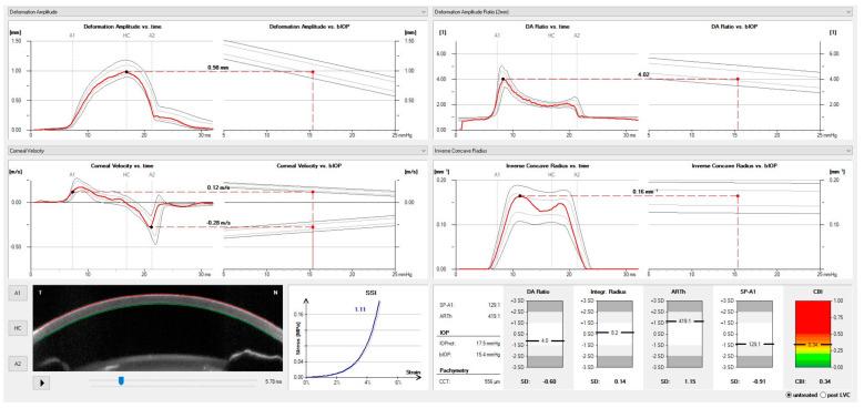 https://cdn.ncbi.nlm.nih.gov/pmc/blobs/01c2/10204549/613cce833dff/vision-07-00036-g005.jpg