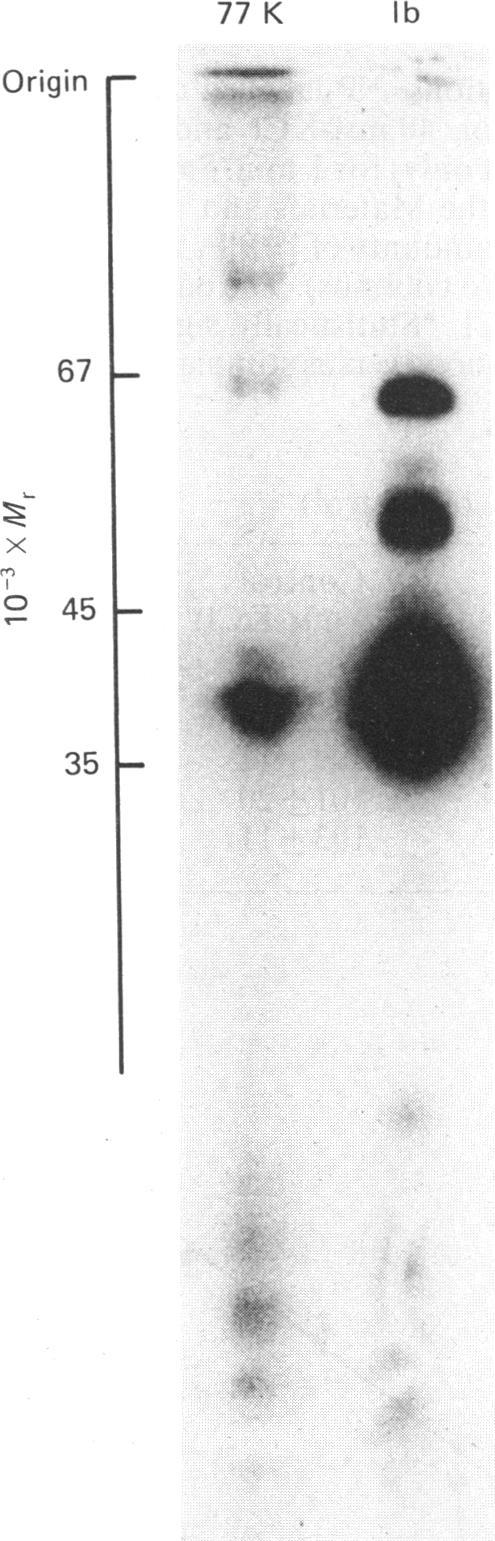 https://cdn.ncbi.nlm.nih.gov/pmc/blobs/01c7/1152931/c7153d63f9a7/biochemj00289-0016-a.jpg